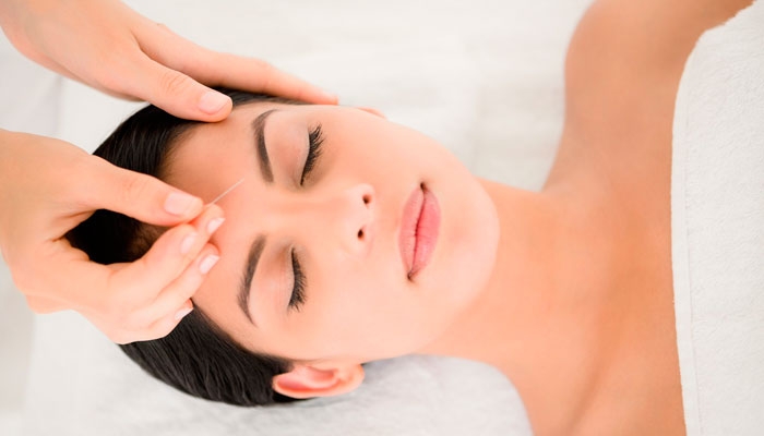 Acupuntura na Subsede Centro-Leste