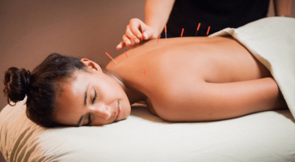 Subsede Centro-Leste oferece acupuntura