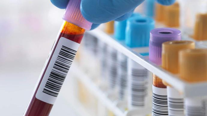 Campanha de prevenção à hepatite C nos dias 3 e 4 de julho no HSPE