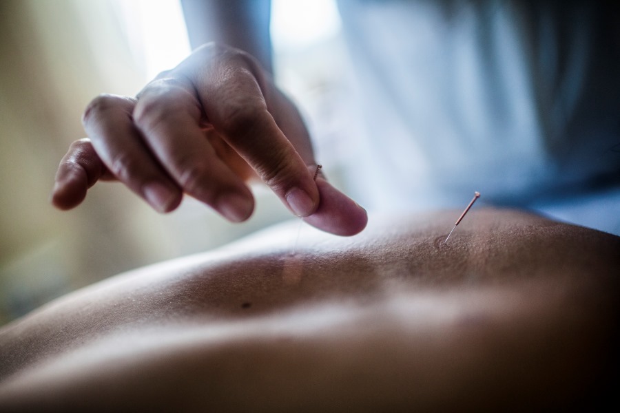 Subsede Norte oferece acupuntura, entre outros serviços, aos associados